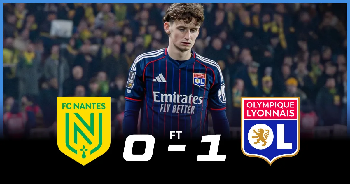 Nantes vs Lyon Player Ratings